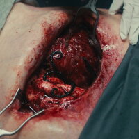 Dead Reset Crack Download